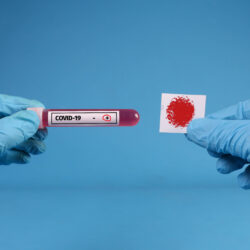 Doctor hands analyzing Coronavirus COVID 19 test blood Foto: Marco Verch | ccnull.de | CC-BY 2.0