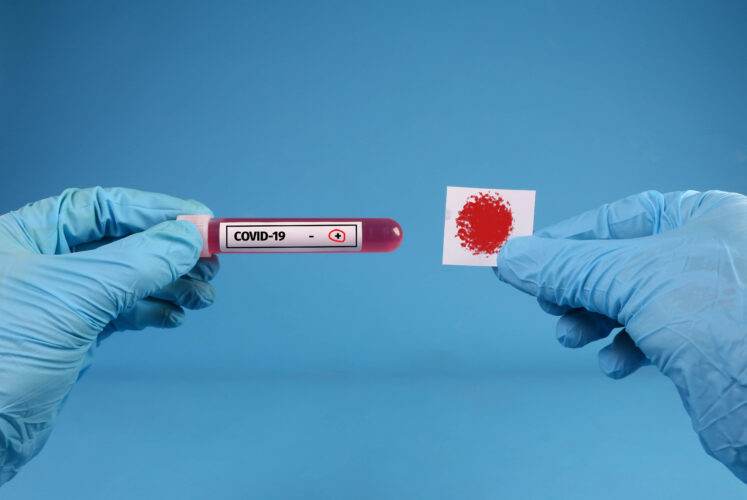 Doctor hands analyzing Coronavirus COVID 19 test blood Foto: Marco Verch | ccnull.de | CC-BY 2.0